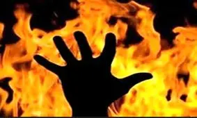 یک زن و شوهر در شهرستان کوثر دچار سوختگی شدند