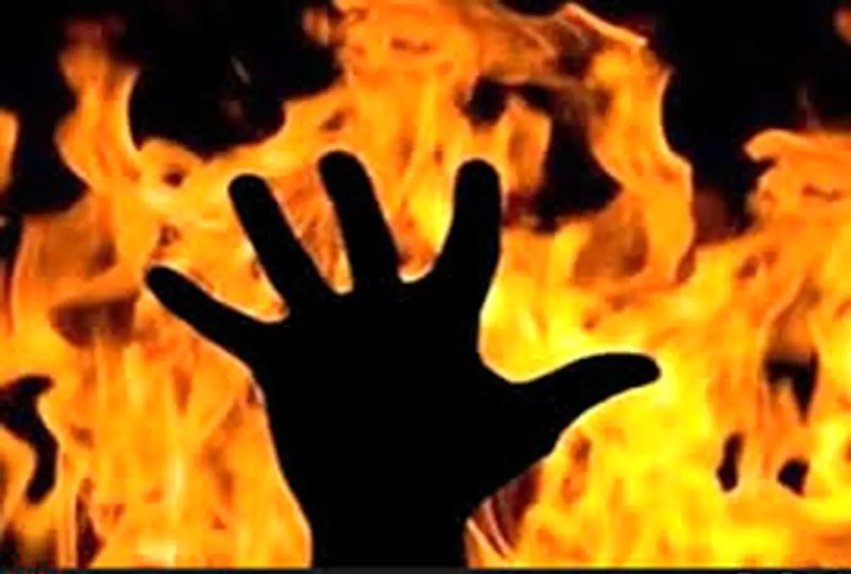 یک زن و شوهر در شهرستان کوثر دچار سوختگی شدند