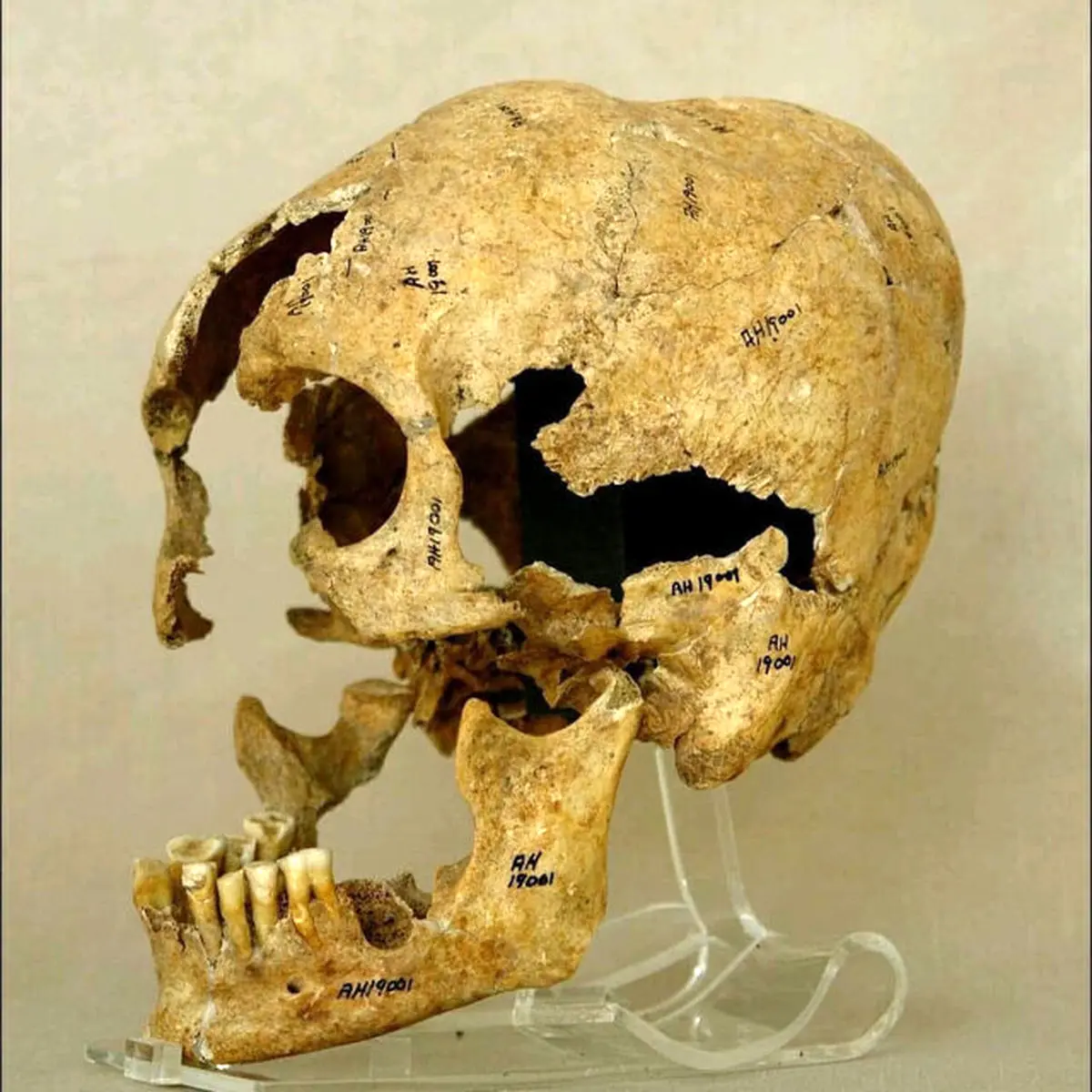 راز جمجمه ۹۰۰۰ ساله یک زن لرستانی / پرده‌برداری از ایجاد یک تغییر عمدی در عهد باستان