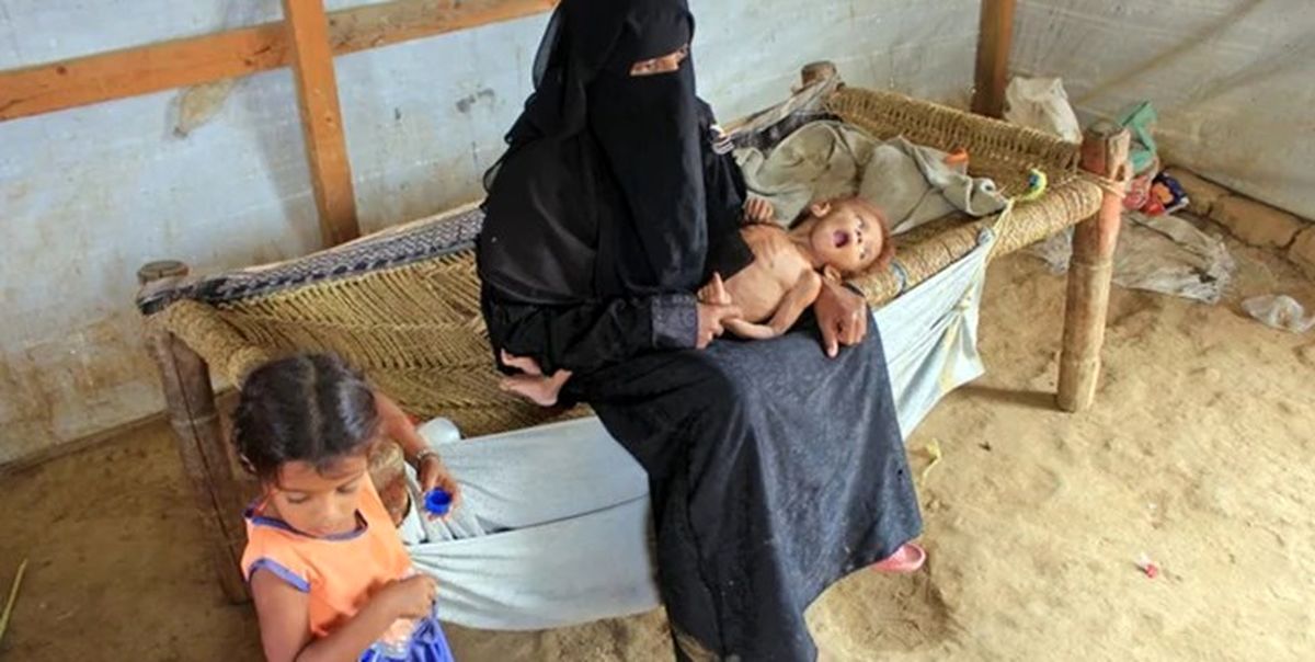 سازمان‌ملل: یک میلیون زن باردار یمنی در خطر سوءتغذیه شدید قرار دارند