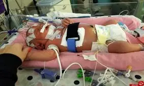 یک بوس کوچولو اما مرگبار+عکس