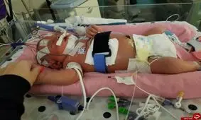 یک بوس کوچولو اما مرگبار+عکس