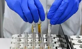 کشف گونه جدید ویروس کرونا در جمهوری چک