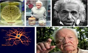 پشت پرده تشریح بدون اجازه مغز اینشتین چیست؟