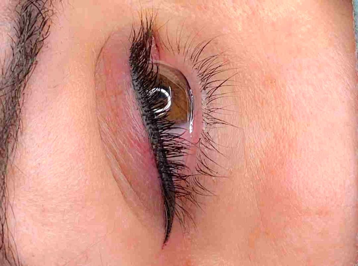 درمان سریع التهاب چشم بعد از تاتو خط چشم