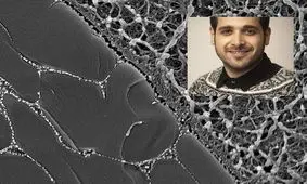 تولید غضروف مصنوعی با توان تحمل بالا توسط محقق ایرانی