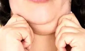 داروی جدید ضدغبغب