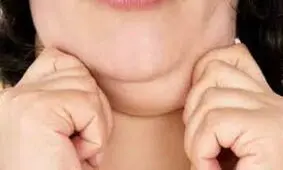 داروی جدید ضدغبغب