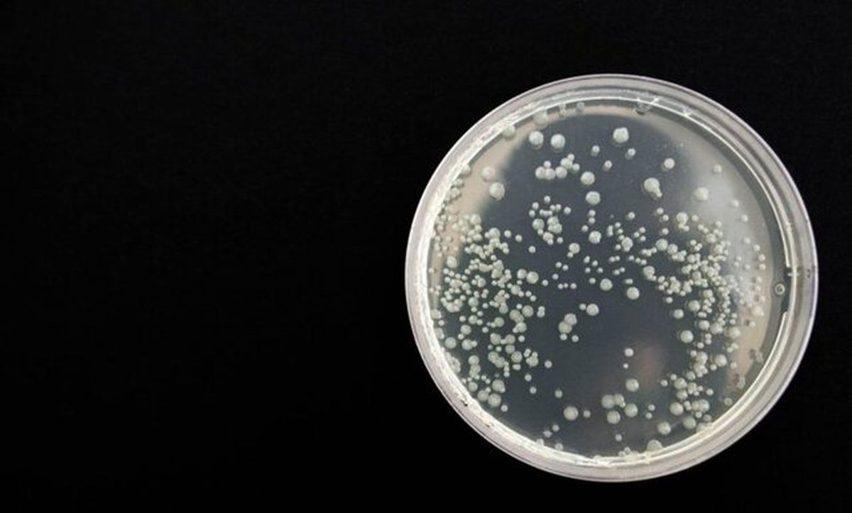 روشی برای تشخیص سریع عفونت‌های باکتریایی و ویروسی