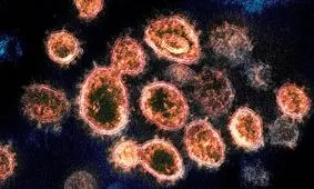 عجیب‌ترین تصویر دوران کرونا/ عکس