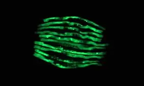 باکتری‌هایی که می‌توانند عامل بروز آلزایمر و پارکینسون باشند