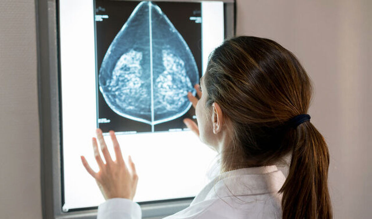 تغییر تومور به کمک درمان بهتر سرطان پستان آمد