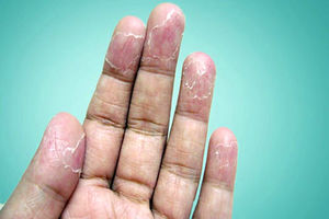 استفاده از این محصولات در خانه می‌تواند ناراحتی پوستی ایجاد کند