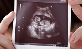 طرح جوانی جمعیت یا تولد سالانه ۷۰۰ نوزاد دارای معلولیت؟/ سقط‌های زیر زمینی افزایش پیدا می‌کند