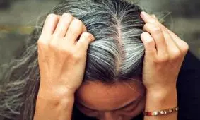 جلوگیری از سفید شدن موها