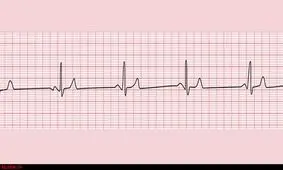 عمل آنژویوگرافی حجت‌الاسلام کروبی به پایان رسید/ انتقال کروبی به بخش مراقبت‌های ویژه