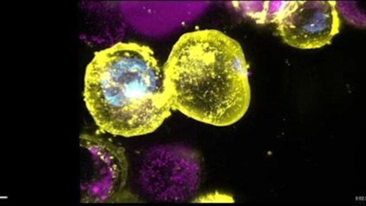 دستگیری پروتئین قاتل با روشی جدید