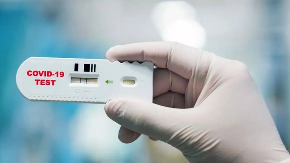 تولید کیت تشخیص آنتی بادی‌های خنثی کننده کرونا