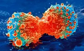 روشی جدید جهت جلوگیری از عود مجدد سرطان در بیماران