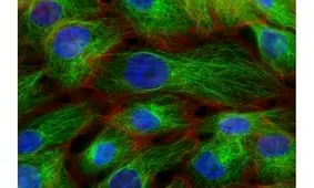 ارتباط شاخص توده بدنی و سرطان پستان