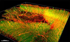 هیدروژلی که سبب ترمیم نورون‌ها پس از ضربه مغزی می‌شود