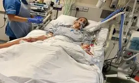 باکتری گوشتخوار زن میانسال را تا حد مرگ پیش برد