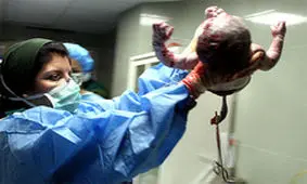 روند کاهشی زاد و ولد در کشور/ فرصت مداخله کوتاه است