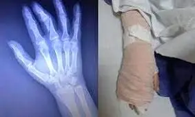 زوایایی تلخ از ماجرای خبرنگاری که کتک خورد!