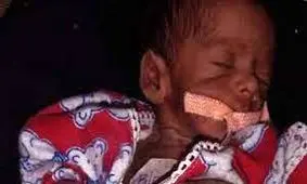 حمله موش ها به نوزاد در بیمارستان