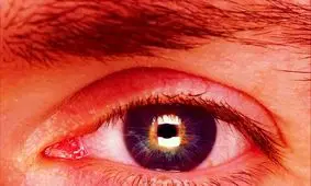 چشم زخم؛ واقعیت یا خرافه؟!