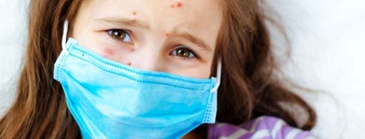 صدای پای سرخک در برخی از استانها بهگوش میرسد