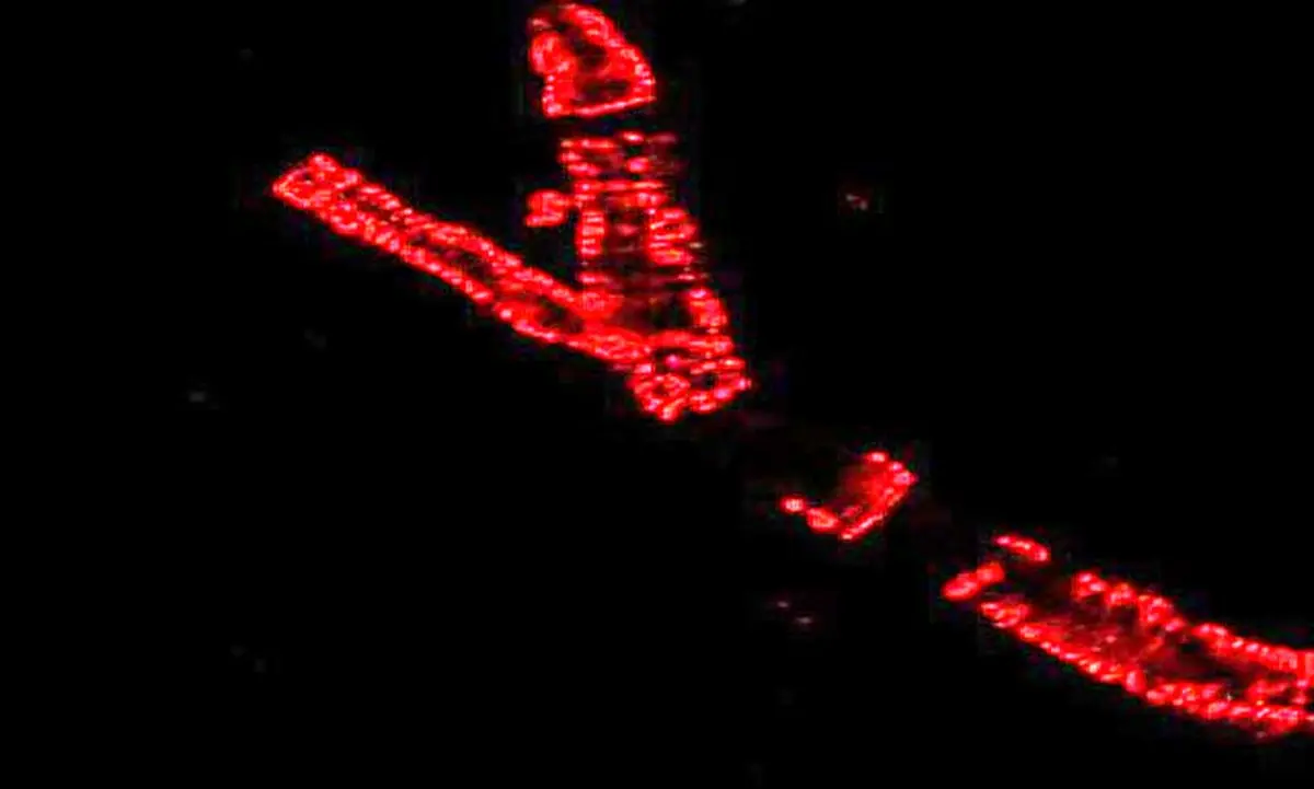 عملکرد غیرمنتظره فلز "روی" در تنظیم فشار خون