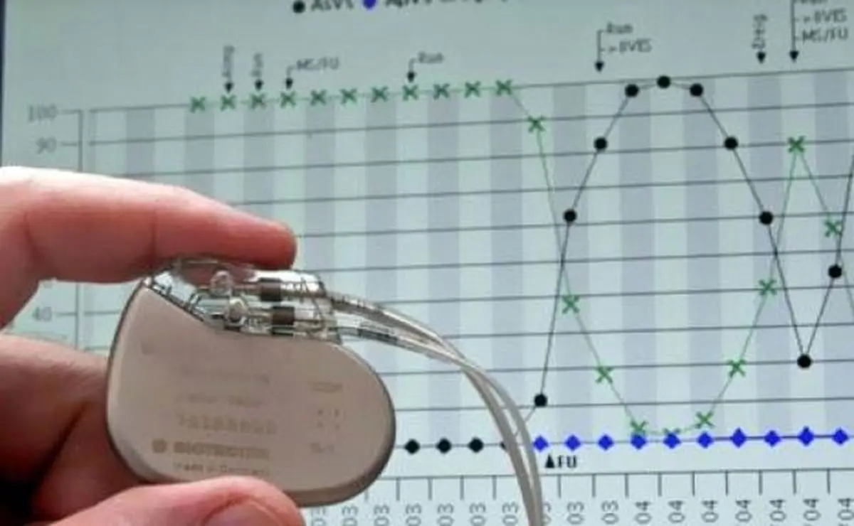 کار گذاشتن «باتری» در قلب مهدی کروبی