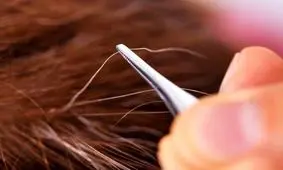 آیا مو یک شبه سفید می‌شود؟