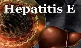 درباره هپاتیت E چه می‌دانیم؟