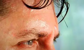 عرق کردن صورت نشانه چیست؟