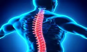 همه چیز درباره فتق دیسک بین مهره ای