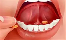 قرص زیر زبانی چیست ؟