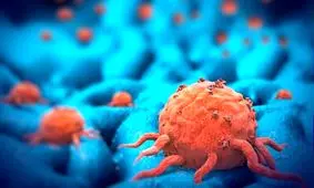 انواع سرطان‌ و راه‌های پیشگیری از ابتلا به این بیماری