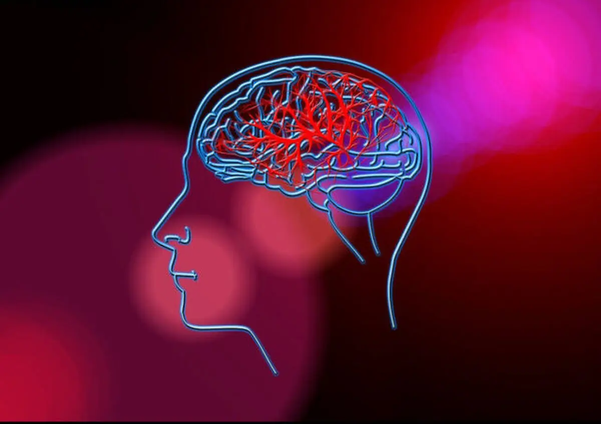 پیش‌بینی احتمال سکته مغزی با یک تراشه کوچک