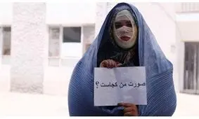 اسیدپاشی خواهرشوهر انتقام‌جو به عروس! / آخرین حکم + جزییات