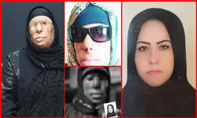 هولناکترین اسیدپاشی به مادر و دختر/ ویدئو