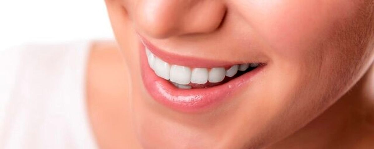 این لبخند زیبا به ضرر شما تمام میشود!