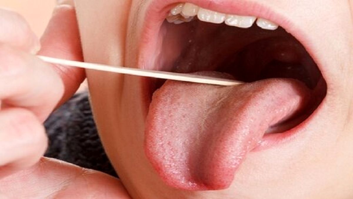 چرا دچار خشکی دهان میشویم؟