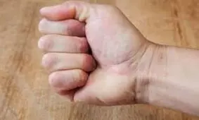 شخصیت شناسی: نحوه مشت کردن دست، رازهای درونی شما را برملا می کند