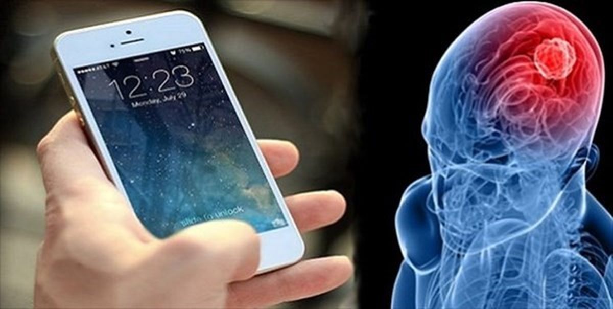 تاثیرات منفی اشعههای موبایل بر مغز انسان