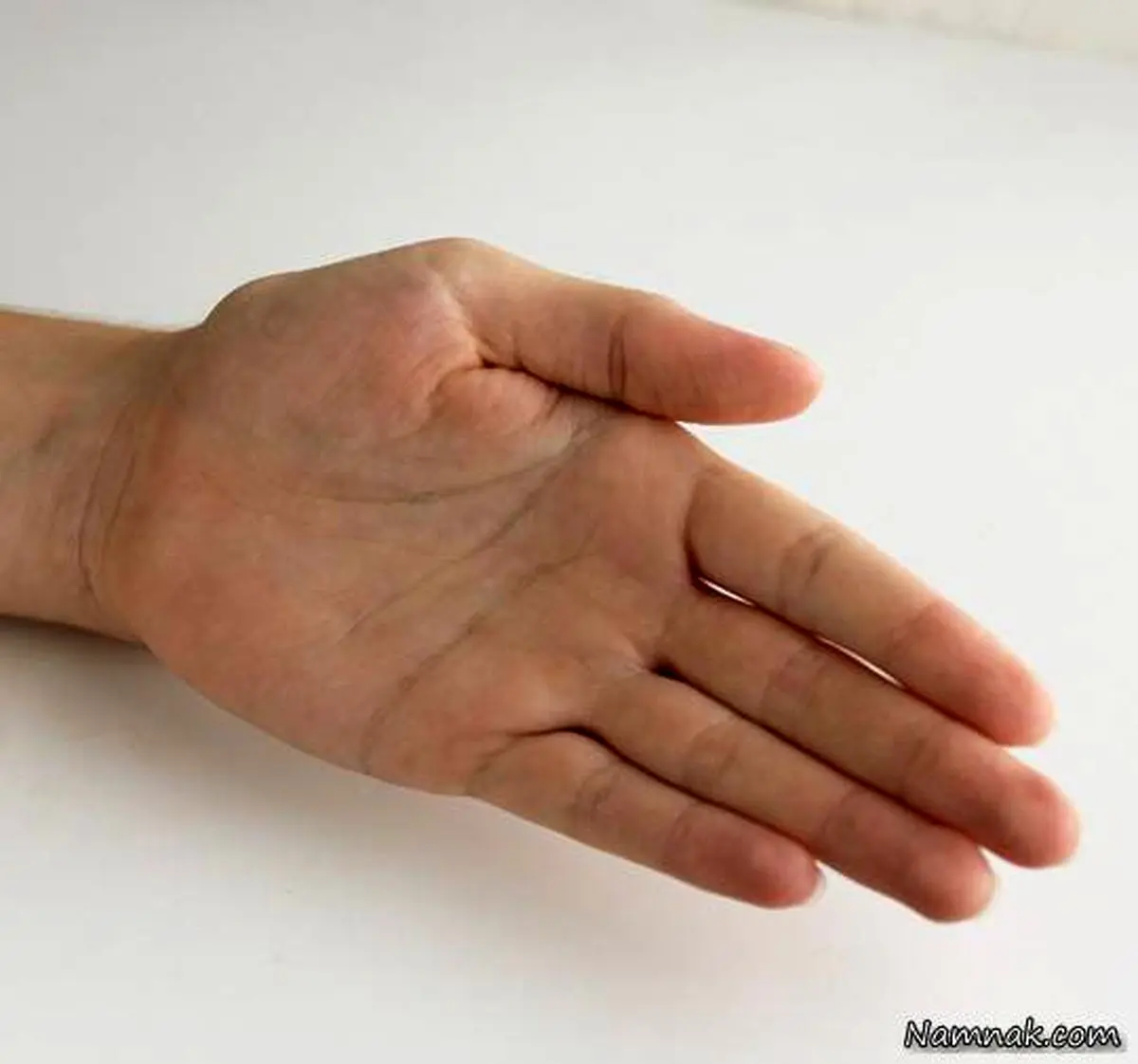 آیا خارش کف دست نشانه پول است ؟