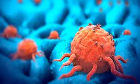 درمان سرطان با عوارض جانبی کمتر