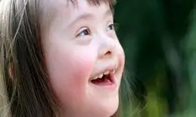 واکنش زیبای گزارشگر تلویزیون در برابر یک کودک سندرم داون/ ویدئو