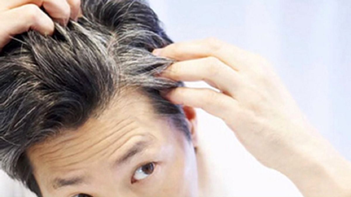 دلایل سفید شدن مو در سنین جوانی و راهکار درمان آن